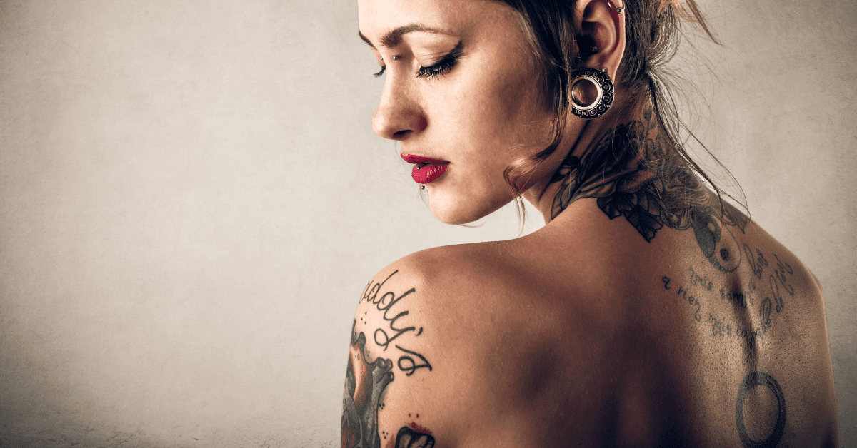 Large tattoo removal