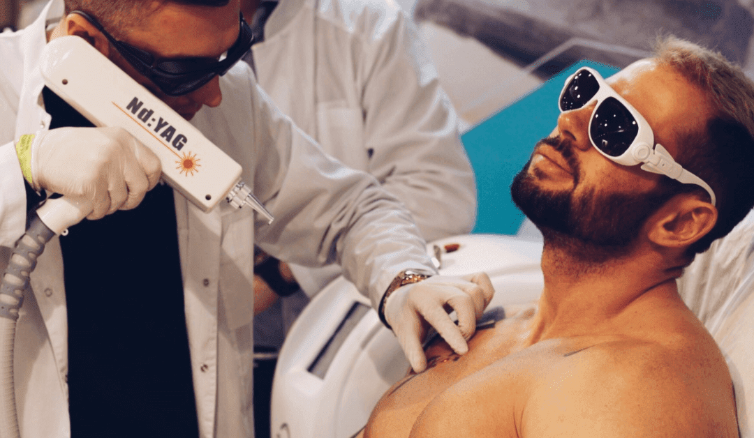 What should you know about laser tattoo removal?