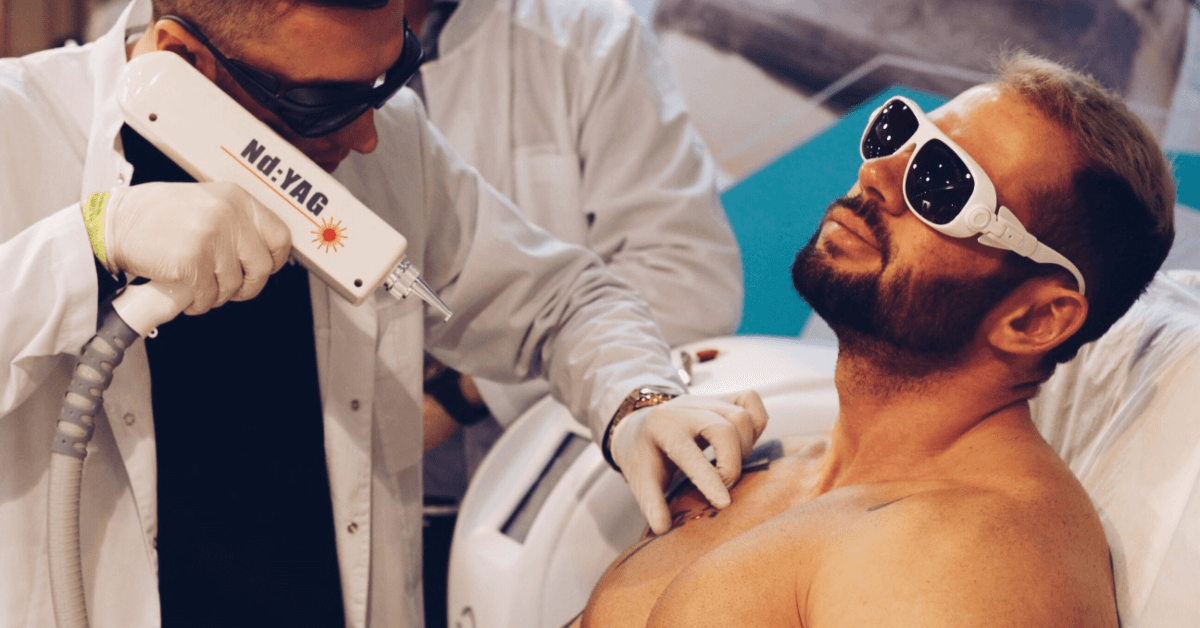 Laser tattoo removal