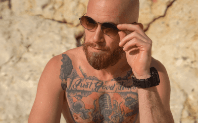 Can You Be In The Sun After Laser Tattoo Removal In Summer?