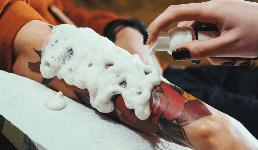 Tattoo Removal Cream Vs. Laser Tattoo Removal: Which Is Better?