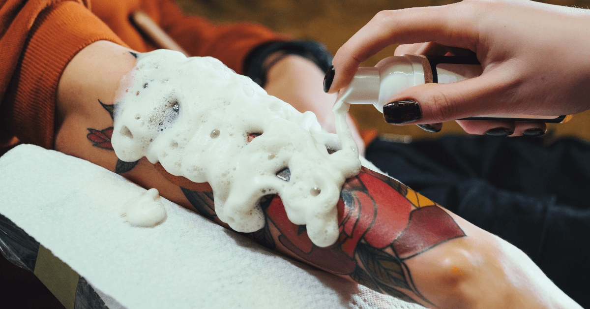 Tattoo Removal Cream Vs. Laser Tattoo Removal