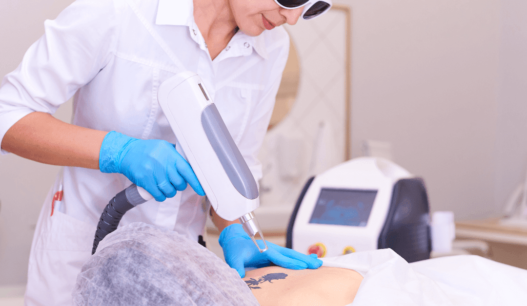 Winter Park Tattoo Removal for New Tattoos!