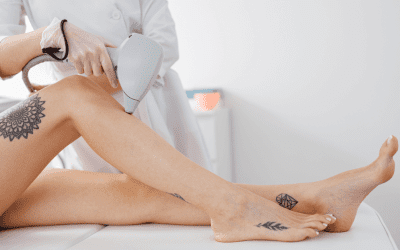 Start Laser Tattoo Removal Treatments Now and be Tattoo Free By Summer!