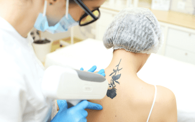 Say Goodbye to Ink and Scars: The Best Tattoo Removal Treatment