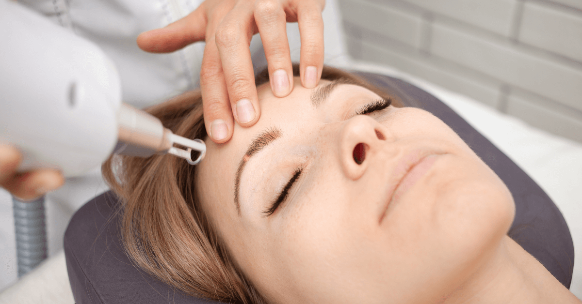 eyebrow tattoo removal