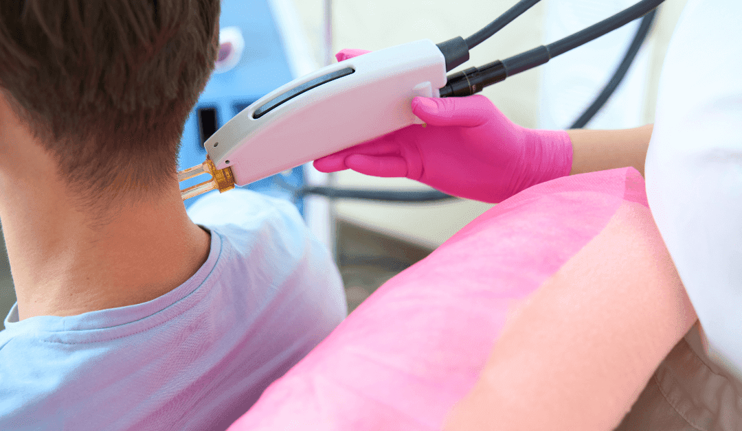 Tattoo Regret? Learn Why Some Body Parts Make Removal a Breeze
