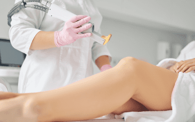 Say Goodbye to Scars: How Laser Treatment Works Wonders?