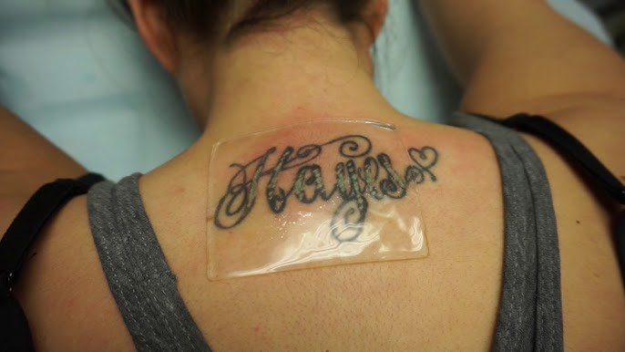 A Step-by-Step Guide to PFD Patch Laser Removal: What Patients Should Know
