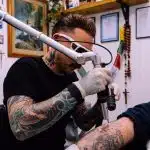 Blue Ink Tattoo Removal