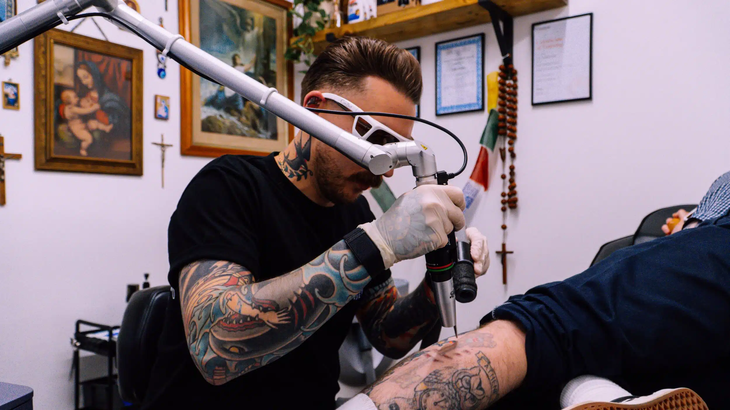 Blue Ink Tattoo Removal