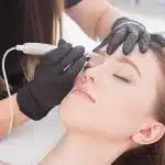 Acne Scar Removal Orlando