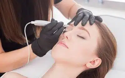 Acne Scar Removal Orlando
