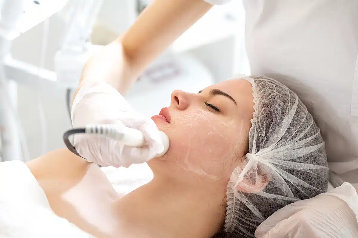 Acne Scar Removal Orlando