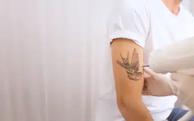 Cream To Remove Tattoos