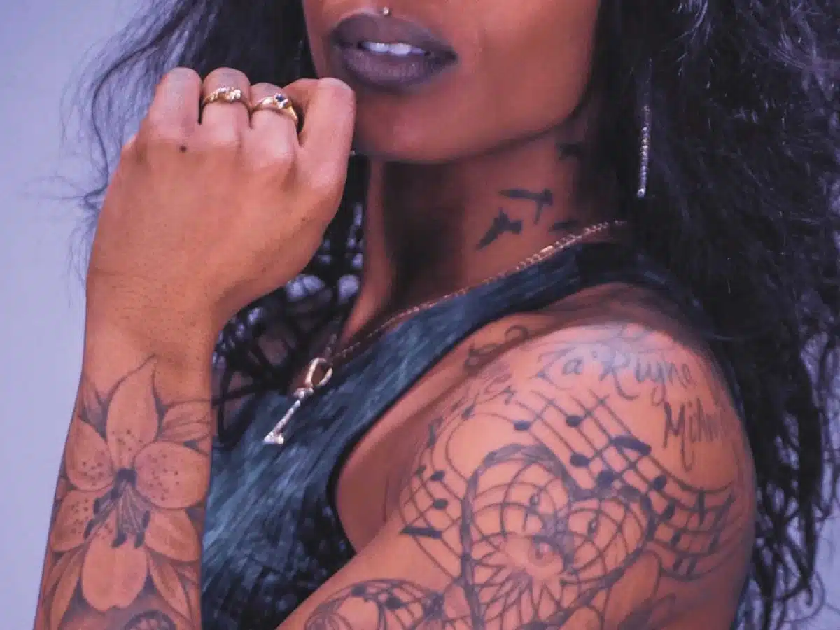 Laser Tattoo Removal On Dark Skin