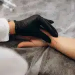 Tattoo Removal Before and After Orlando