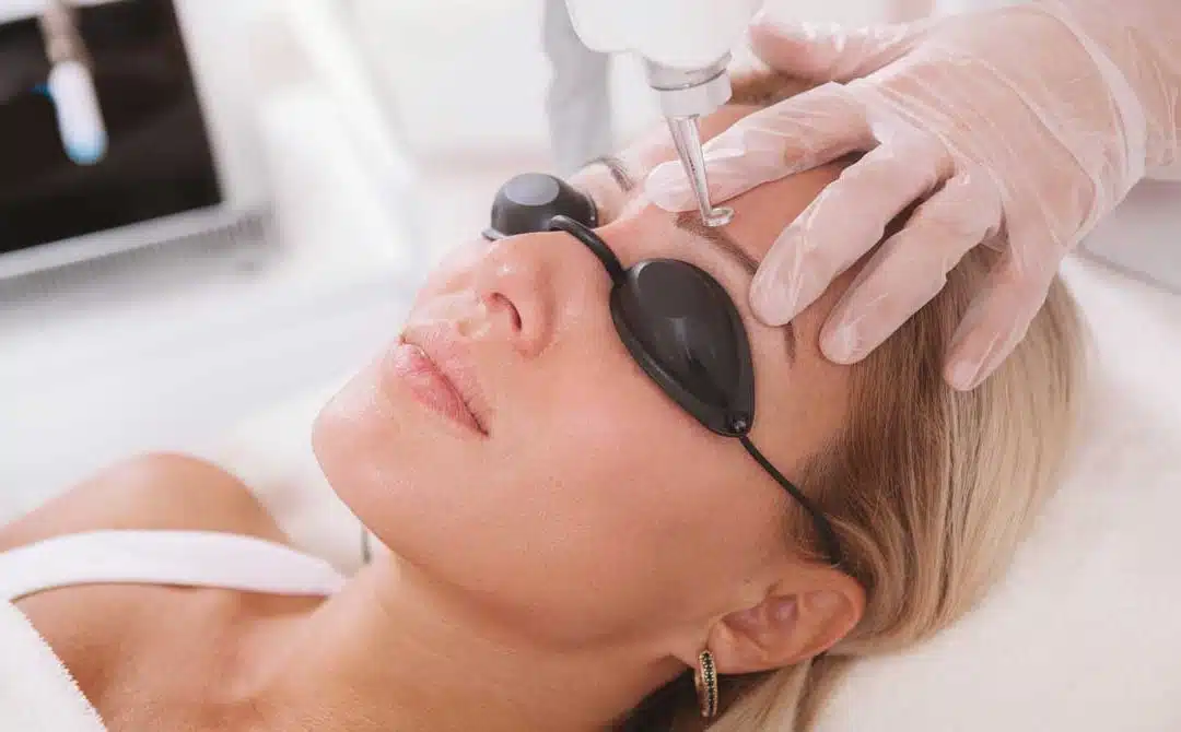 cosmetic tattoo removal