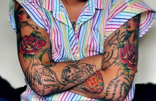 Best Tattoo Removal by Color