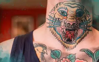 Laser Tattoo Removal by Color: Challenges, Solutions & Results