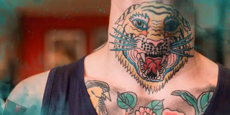 Laser Tattoo Removal by Color: Challenges, Solutions & Results