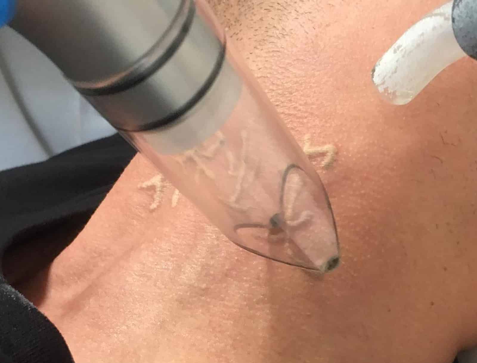 Experience Smooth, Radiant Skin Again