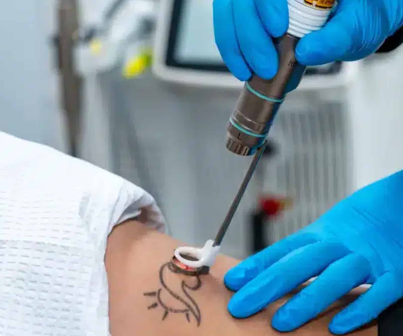 Long-Lasting Results