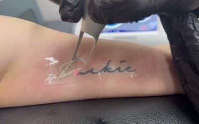 PFD Patch Tattoo Removal Results