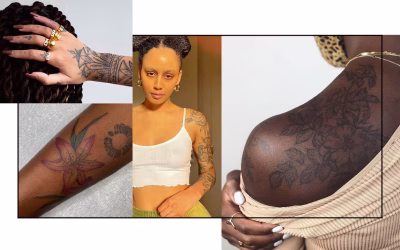 Tattoo Removal Black Skin