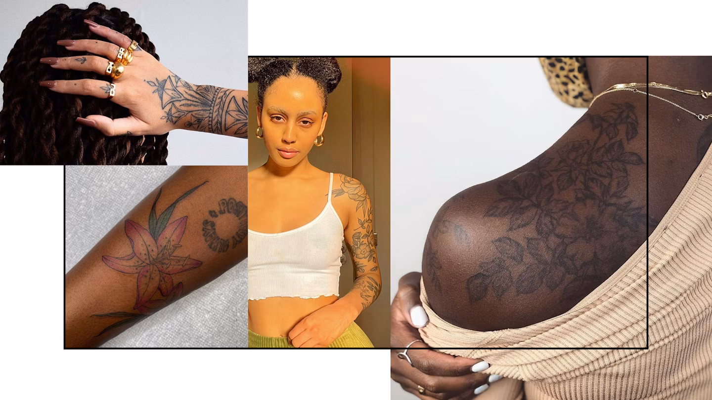 Tattoo Removal Black Skin