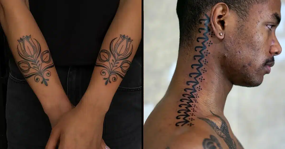 Tattoo Removal Black Skin