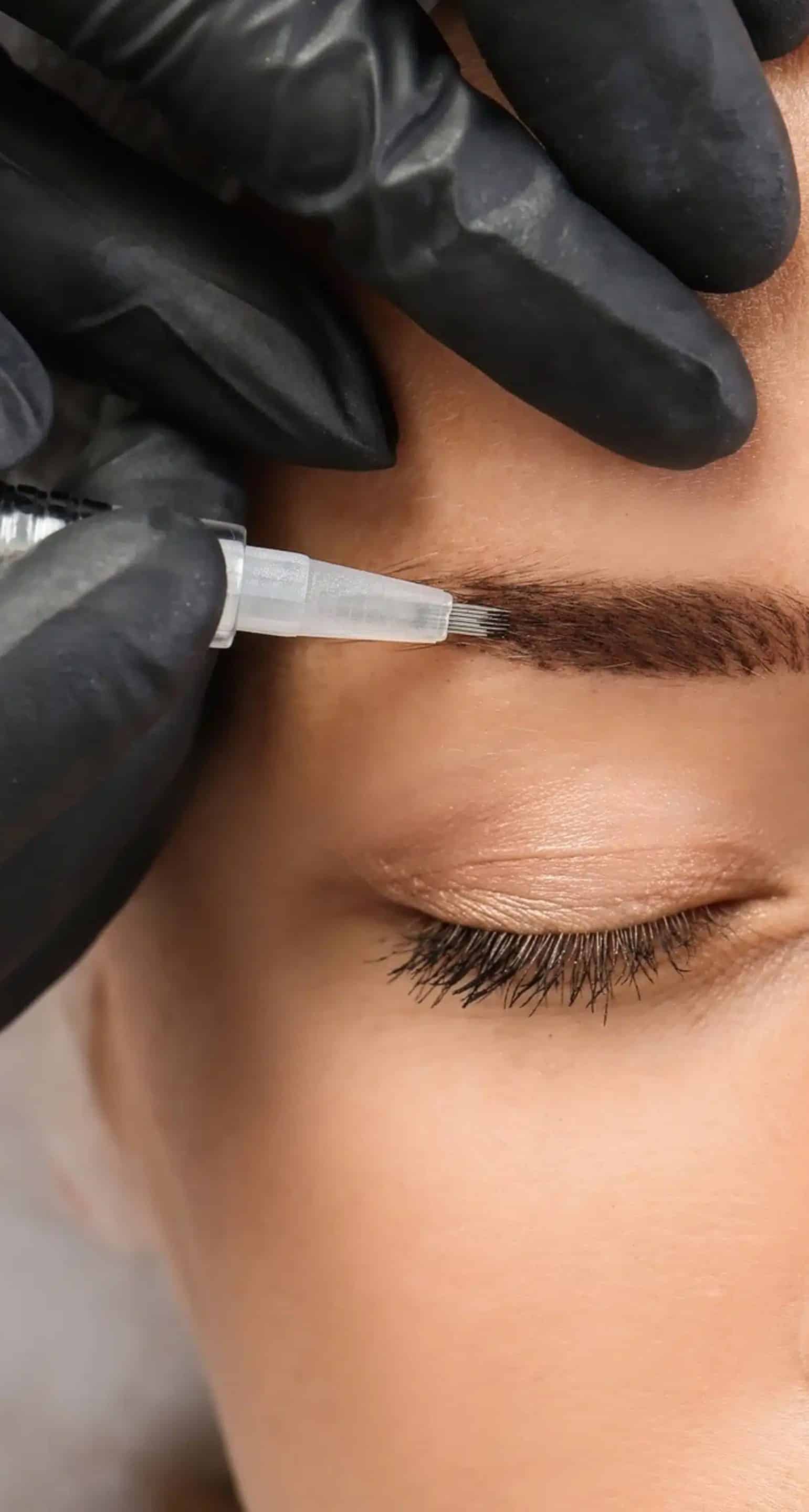 Consultation & Skin Assessment