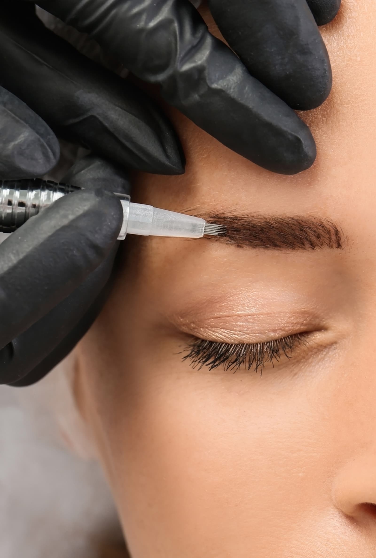 Consultation & Skin Assessment