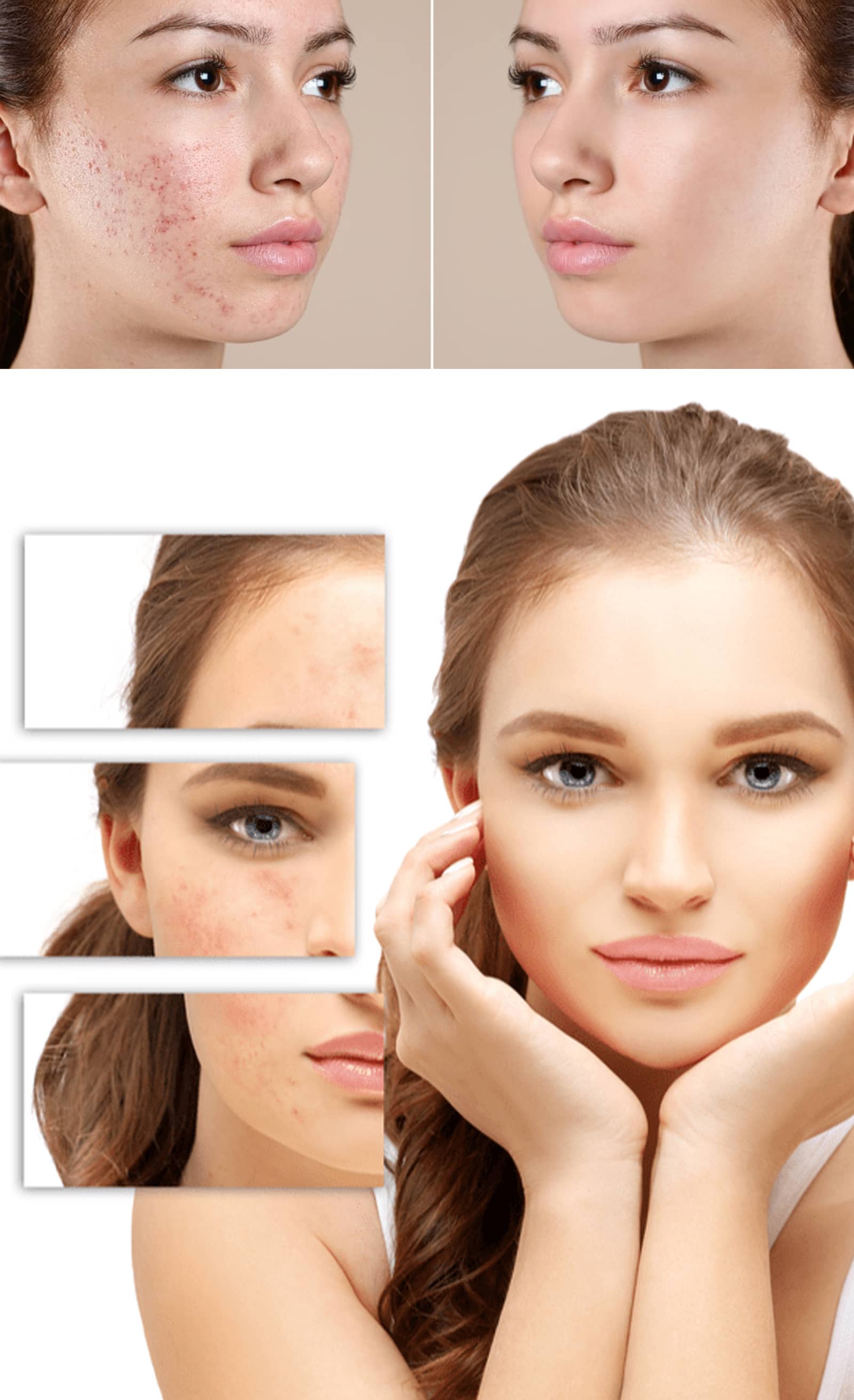 Key Benefits of Laser Scar Removal