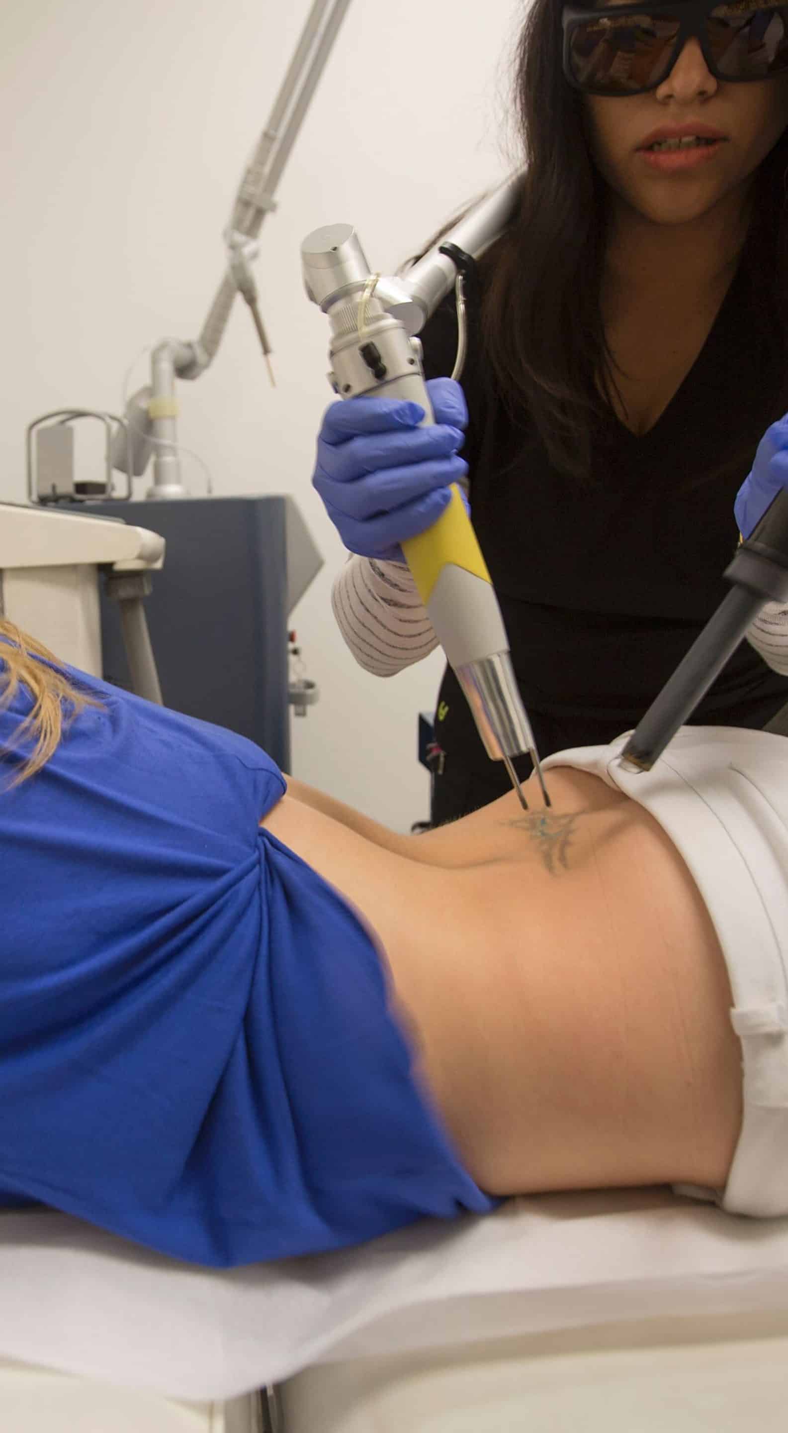 Laser Tattoo Removal