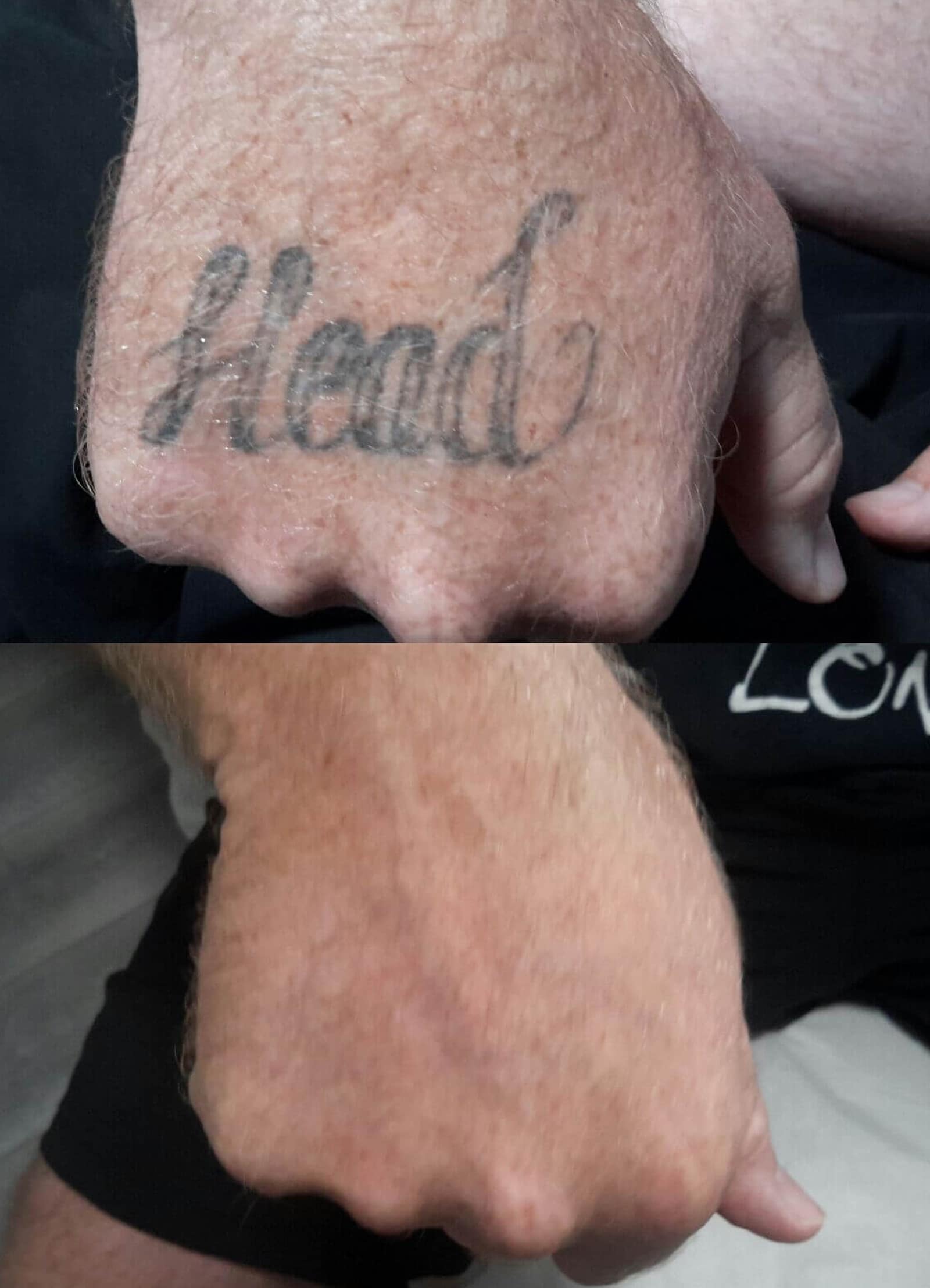 Many Sessions Will You Need