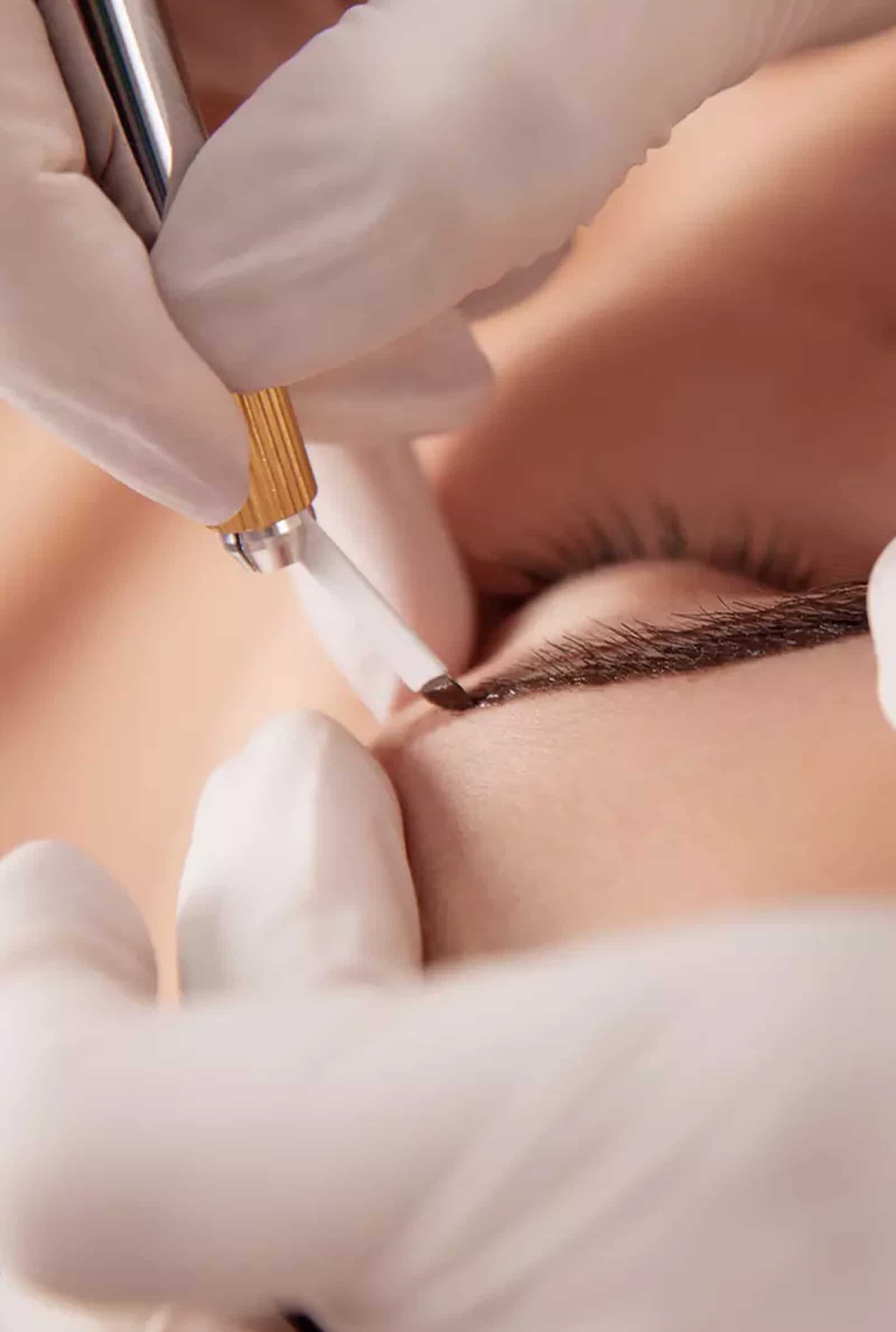 Microblading Removal