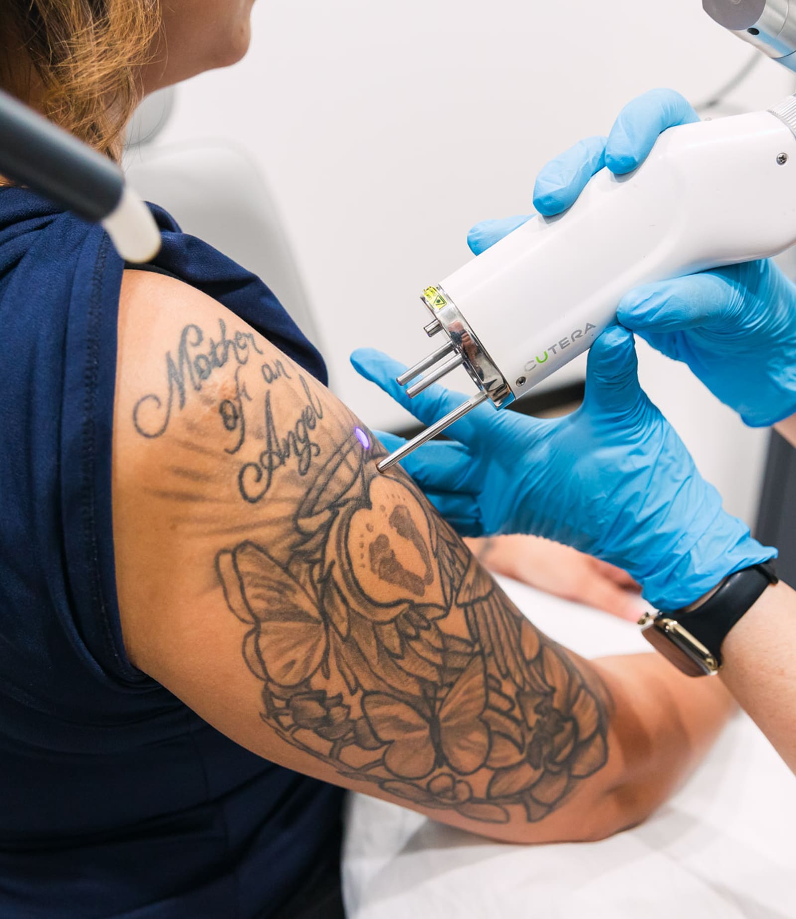 Post-Treatment Care with BLT Cream