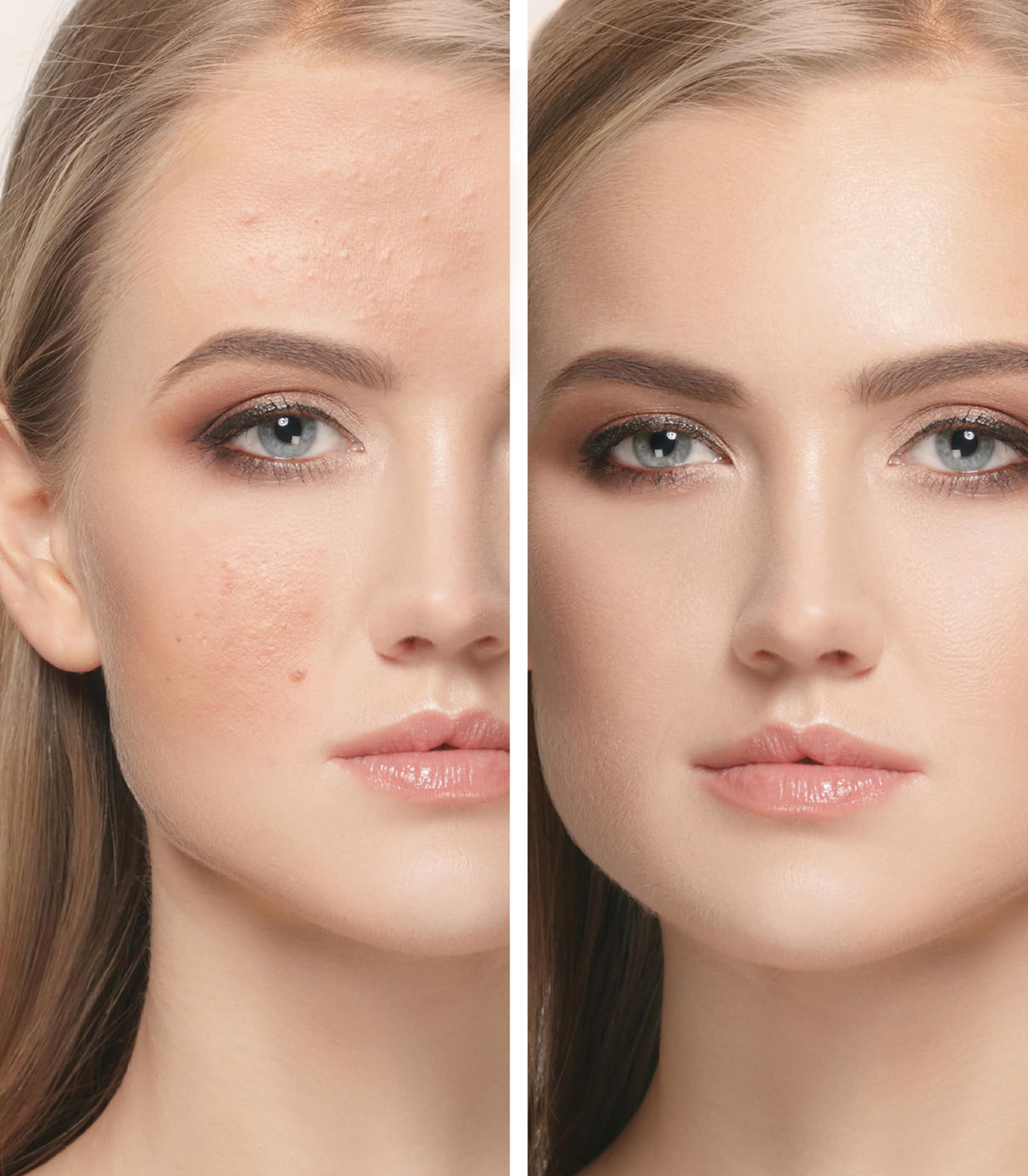 Pre-Treatment Preparation