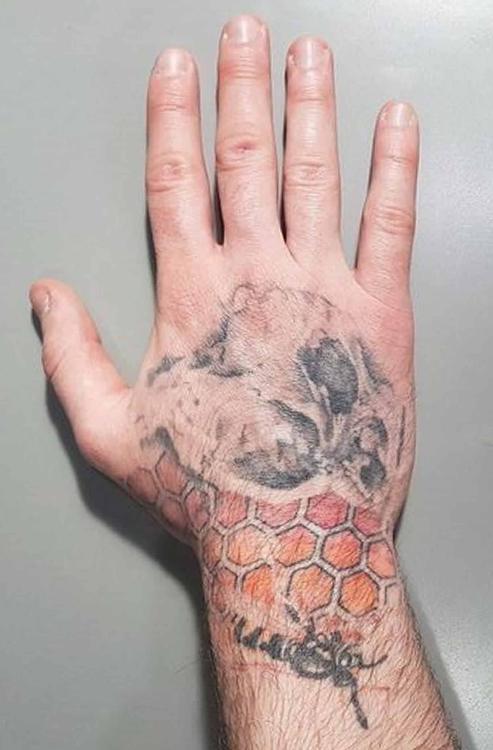 Preparing for Your Tattoo Fading Session