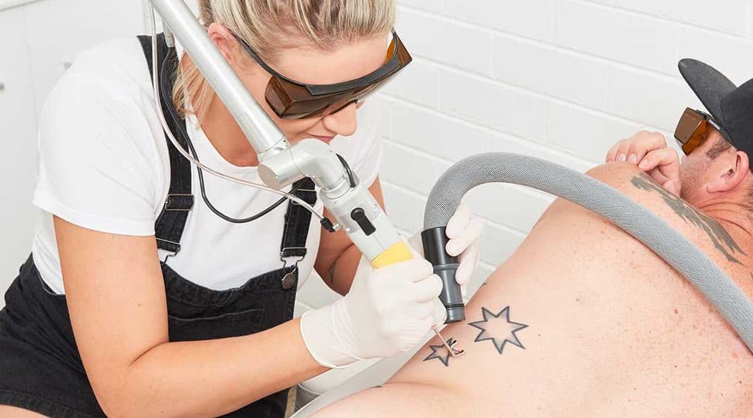 Discover the Most Advanced Tattoo Removal Technology in Winter Park
